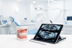 A professional dental model of teeth and gums sits beside a tablet displaying panoramic dental X-rays on a clean white surface. The background features a bright, blurred dental clinic with medical equipment and a dental chair. This image illustrates modern digital dentistry, oral health technology, and professional dental care in a clinical setting.