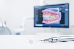 A white dental crown and silver dental handpiece lie on a clean surface in a bright dental clinic. In the blurred background, a computer screen shows a high-tech 3D digital model of human teeth, highlighting modern digital dentistry and CAD/CAM technology used for restorative procedures.