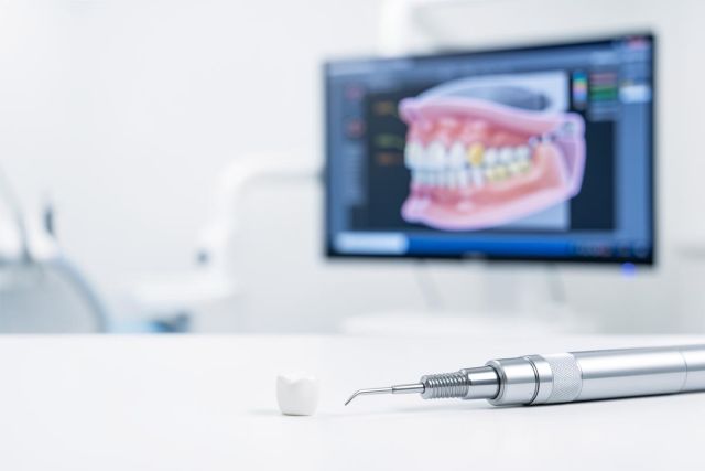 A white dental crown and silver dental handpiece lie on a clean surface in a bright dental clinic. In the blurred background, a computer screen shows a high-tech 3D digital model of human teeth, highlighting modern digital dentistry and CAD/CAM technology used for restorative procedures.